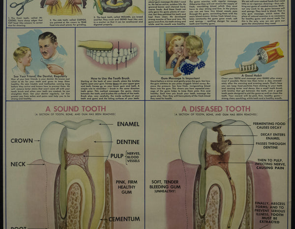 1935 Bristol Myers Ipana Tooth Paste Dental Dentist Office Poster Chart - Golden Age Posters